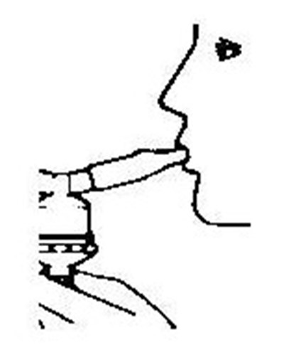 image description - albuterol sulfate fig4 